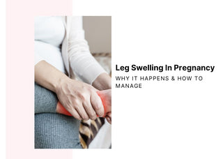 How to Reduce Swelling in Legs During Pregnancy?