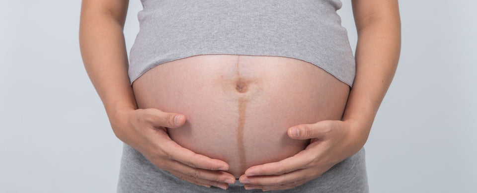 Cream or Oil — What Works Better for Pregnancy Stretch Marks?