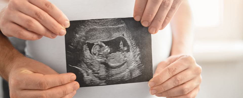 baby gender predictions