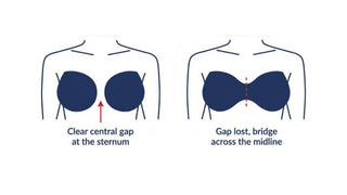 Why Does My Nursing Bra Give Me a Uniboob?