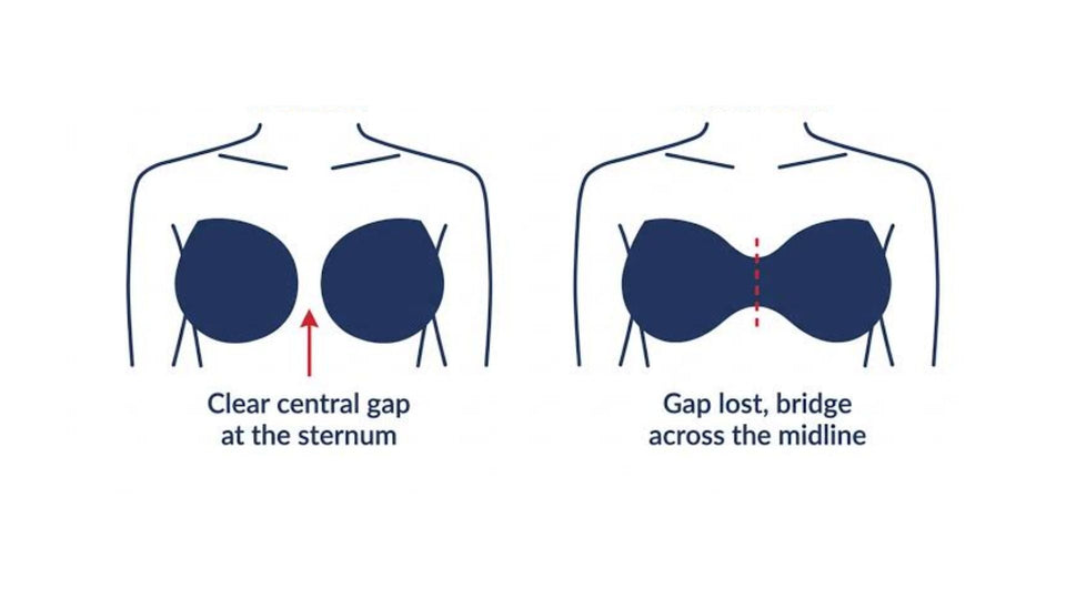 Why Does My Nursing Bra Give Me a Uniboob?