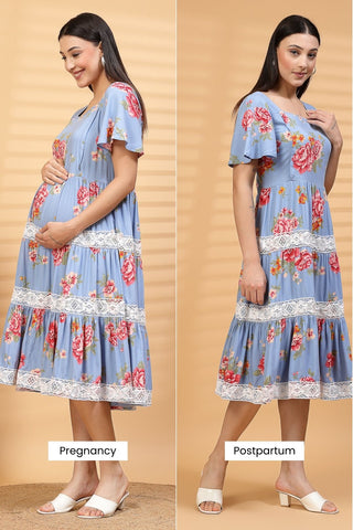 Lace Bloom Maternity Feeding Dress